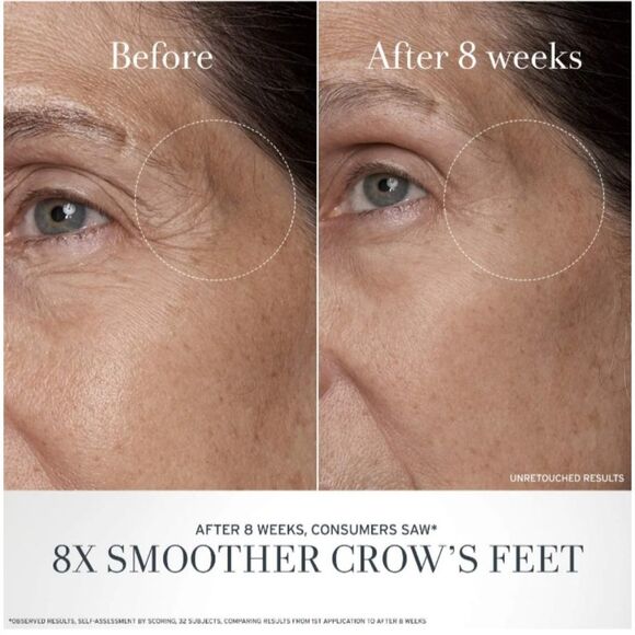 FRESH Black Tea Advanced Age Renewal Anti-Aging Eye Cream - Picture 4 of 8